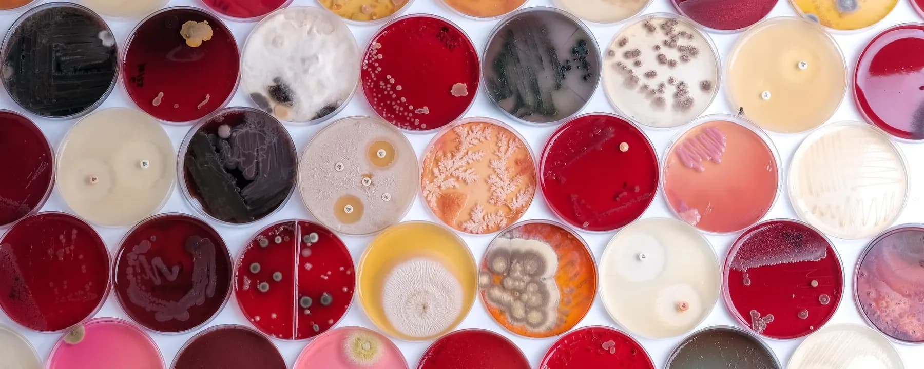 Por qué un blog sobre microbiología: para hablar de lo que nadie habla